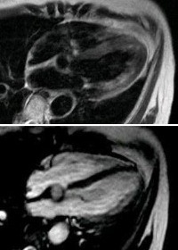 心臓MRIasS.jpg