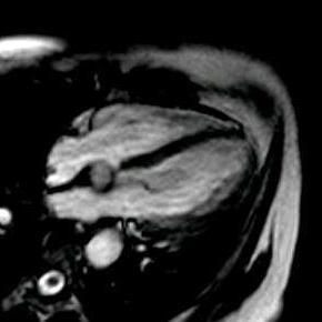 心臓MRIs.jpg