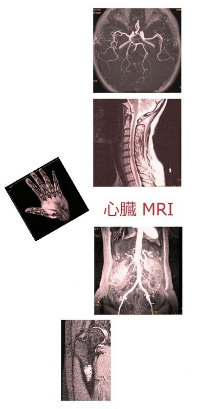 MRI.jpg