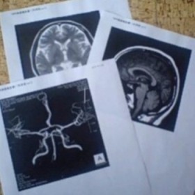 MRI_MRA脳020209.JPG